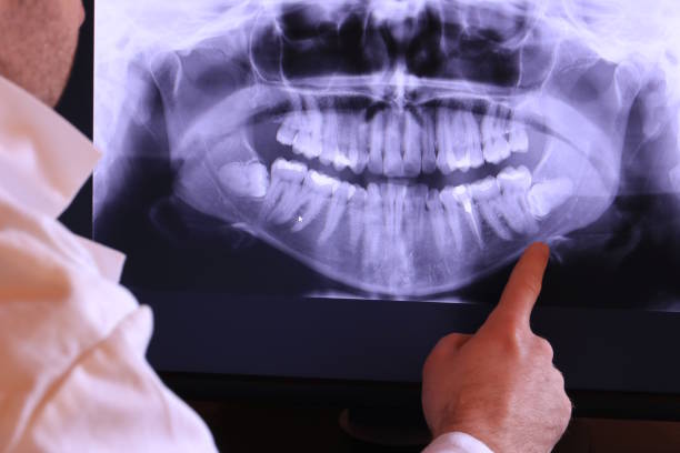 Professional Emergency Dental Service in FL