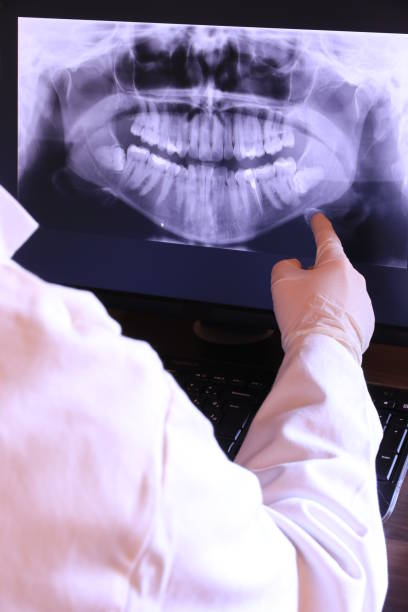 Best Knocked-Out Tooth (Avulsed Tooth) Treatment in Cooper City, FL